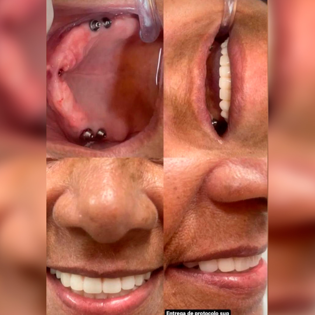 Prancheta 1 copiar 6